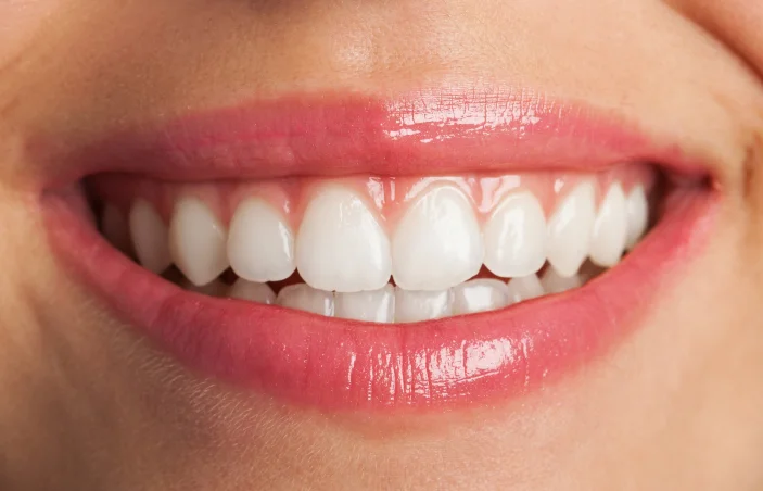 Dent Health Istanbul - Premium Dental Clinic Turkey