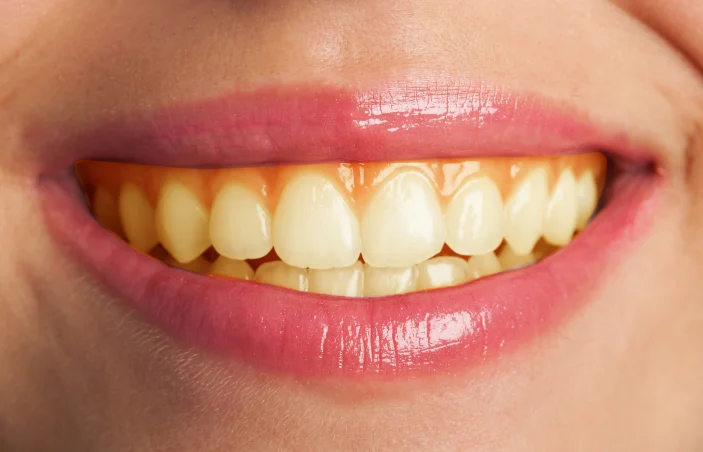 Dent Health Istanbul - Premium Dental Clinic Turkey