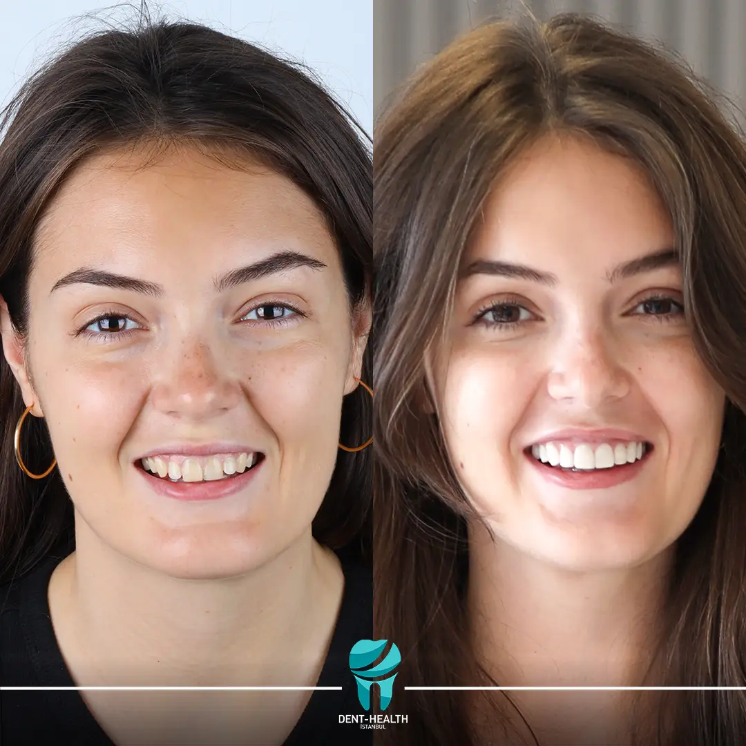 Dent Health Istanbul - Premium Dental Clinic Turkey