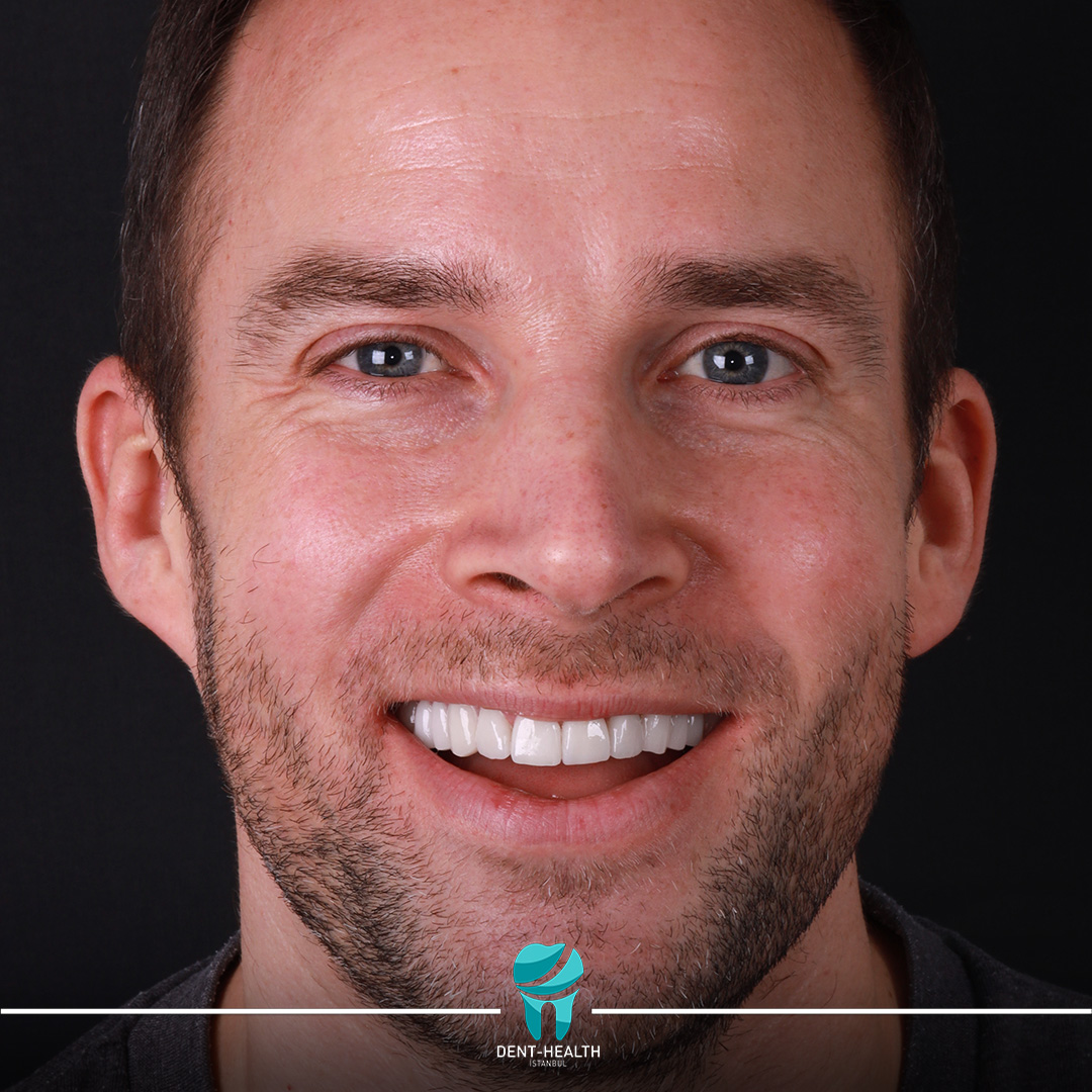 Dent Health Istanbul - Premium Dental Clinic Turkey