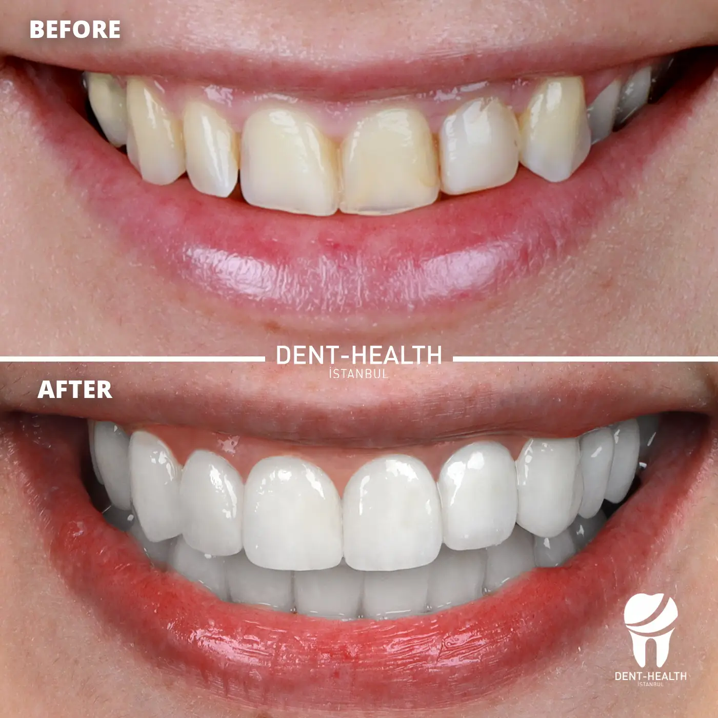 Dent Health Istanbul - Premium Dental Clinic Turkey