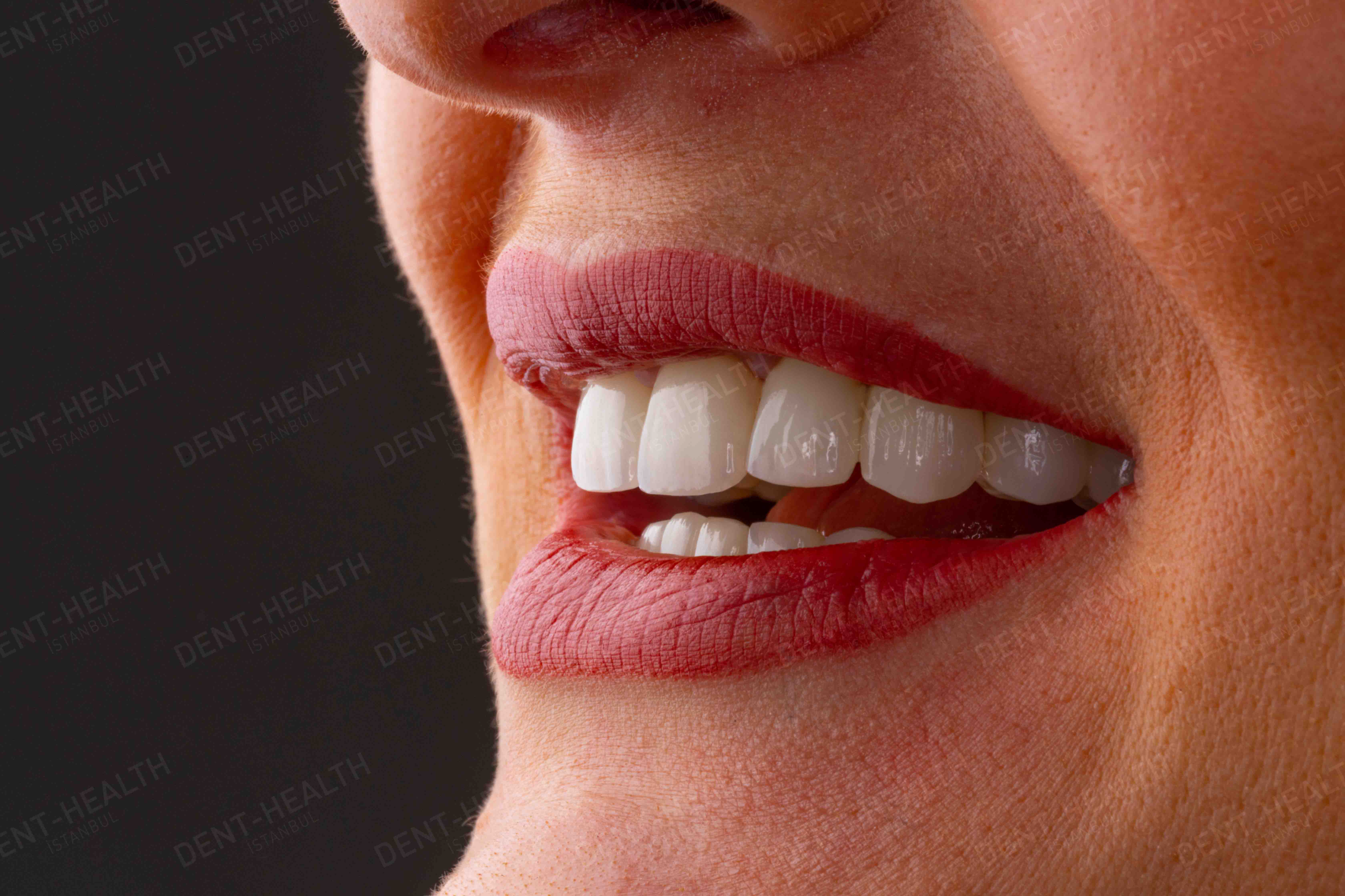 Dent Health Istanbul - Premium Dental Clinic Turkey
