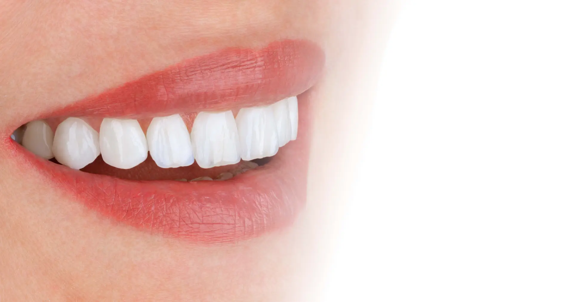 Veneers & Lumineers before and after