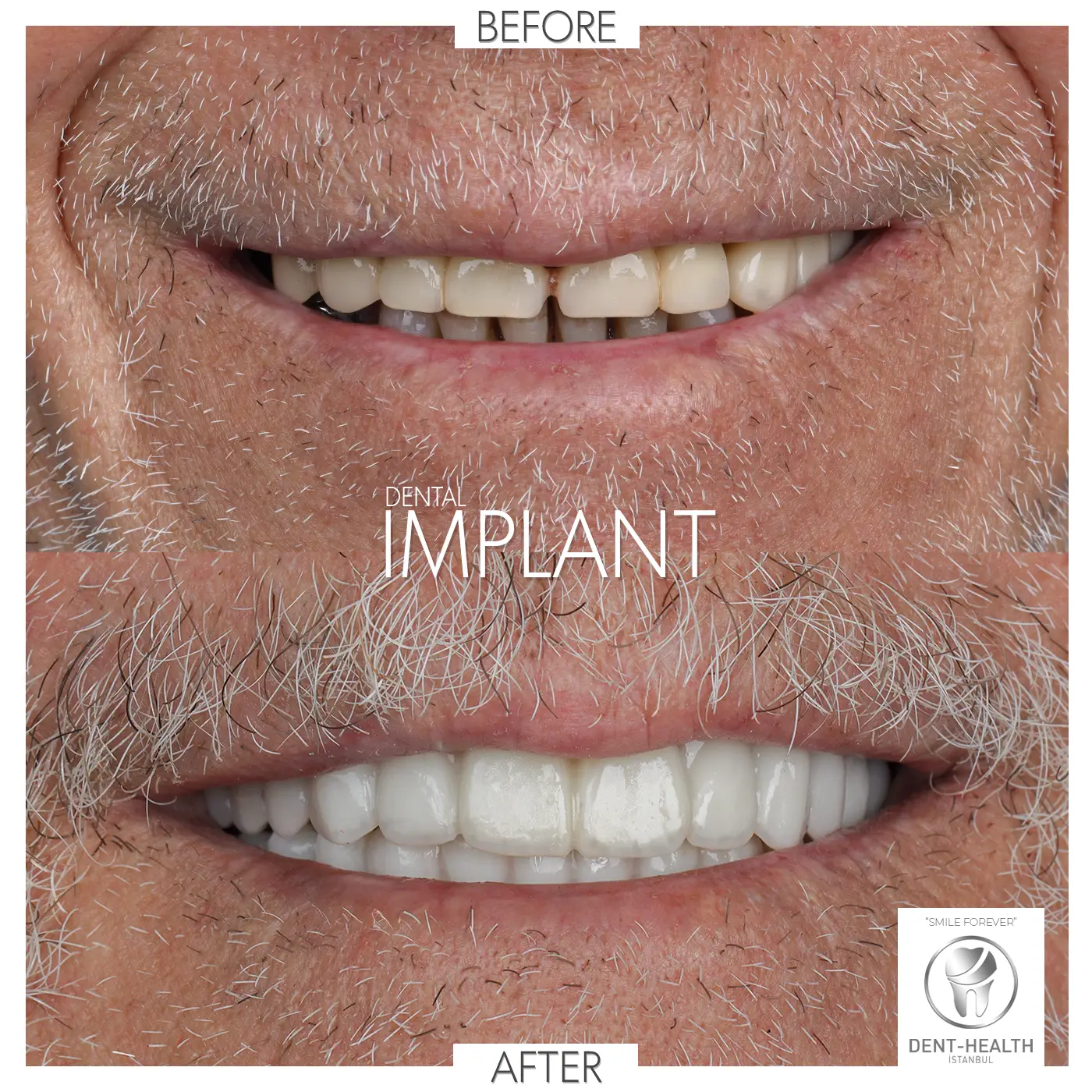 Dent Health Istanbul - Premium Dental Clinic Turkey